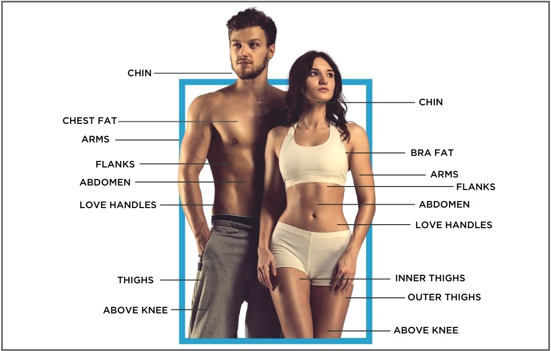 CoolSculpting treatment areas for man and woman